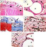 CD34 Antibody in Immunohistochemistry (IHC)