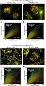 Factor VIII Antibody in Immunocytochemistry (ICC/IF)