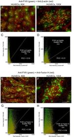 Factor VIII Antibody in Immunocytochemistry (ICC/IF)