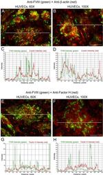 Factor VIII Antibody in Immunocytochemistry (ICC/IF)