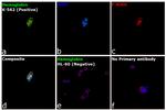 Hemoglobin Antibody