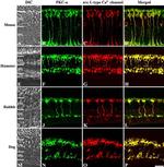 PKC alpha Antibody in Immunohistochemistry (IHC)