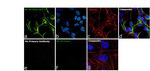 NEFM Antibody in Immunocytochemistry (ICC/IF)