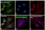 beta-2 Microglobulin Antibody