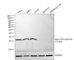 beta-2 Microglobulin Antibody in Western Blot (WB)