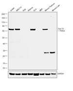 Zap-70 Antibody