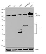 XPC Antibody in Western Blot (WB)