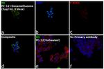 Tyrosine Hydroxylase Antibody