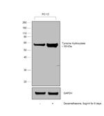 Tyrosine Hydroxylase Antibody in Western Blot (WB)