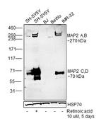 MAP2 Antibody in Western Blot (WB)