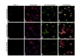 TGF beta-1 Antibody