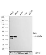 PAI1 Antibody in Western Blot (WB)