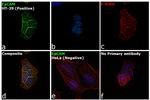 EpCAM Antibody