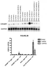 CRABP1 Antibody in Western Blot (WB)