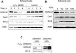 SERCA1 ATPase Antibody in Western Blot (WB)