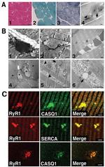 Calsequestrin Antibody in Immunohistochemistry (IHC)