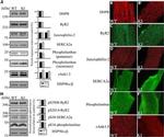 SERCA2 ATPase Antibody in Western Blot, Immunocytochemistry (WB, ICC/IF)