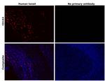 CD163 Antibody in Immunohistochemistry (Paraffin) (IHC (P))