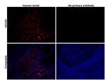 CD163 Antibody in Immunohistochemistry (Paraffin) (IHC (P))