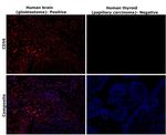 CD56 Antibody in Immunohistochemistry (Paraffin) (IHC (P))