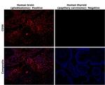 CD56 Antibody in Immunohistochemistry (Paraffin) (IHC (P))