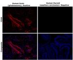 CD56 Antibody in Immunohistochemistry (Paraffin) (IHC (P))