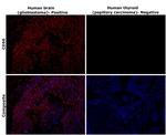 CD56 Antibody in Immunohistochemistry (Paraffin) (IHC (P))