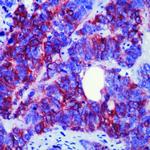 CD56 Antibody in Immunohistochemistry (Paraffin) (IHC (P))