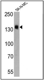 CD56 Antibody in Western Blot (WB)