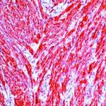 Caldesmon HMW Antibody in Immunohistochemistry (Paraffin) (IHC (P))