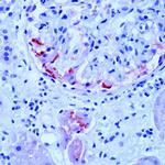 SAA Antibody in Immunohistochemistry (Paraffin) (IHC (P))