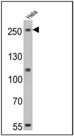 NOTCH1 Antibody in Western Blot (WB)