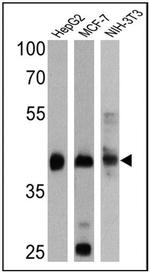 Cytokeratin Pan Type I Antibody in Western Blot (WB)