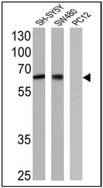 NGFR Antibody in Western Blot (WB)