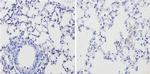 Thrombospondin 1 Antibody in Immunohistochemistry (Paraffin) (IHC (P))