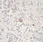 Bax Antibody in Immunohistochemistry (Paraffin) (IHC (P))