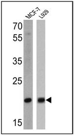 Bax Antibody in Western Blot (WB)