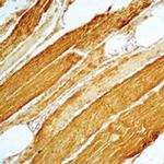 Actin Muscle Antibody in Immunohistochemistry (Paraffin) (IHC (P))