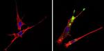 c-Abl Antibody in Immunocytochemistry (ICC/IF)