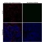 Ki-67 Antibody in Immunohistochemistry (Paraffin) (IHC (P))