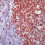 Ki-67 Antibody in Immunohistochemistry (Paraffin) (IHC (P))