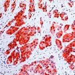 Calretinin Antibody in Immunohistochemistry (Paraffin) (IHC (P))