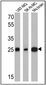 Calretinin Antibody in Western Blot (WB)