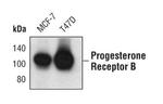 Progesterone Receptor Antibody in Western Blot (WB)