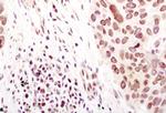 SUMO1 Antibody in Immunohistochemistry (Paraffin) (IHC (P))