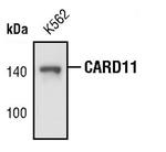 CARD11 Antibody in Western Blot (WB)