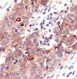 CEA Antibody in Immunohistochemistry (Paraffin) (IHC (P))