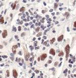 Survivin Antibody in Immunohistochemistry (Paraffin) (IHC (P))