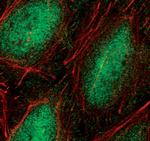 Phospho-NFkB p65 (Ser536) Antibody in Immunocytochemistry (ICC/IF)