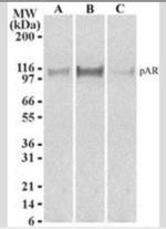 Phospho-Androgen Receptor (Ser213, Ser210) Antibody in Western Blot (WB)